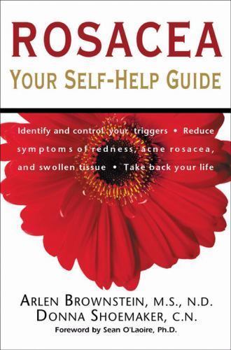 Rosacea: Your Self-Help Guide