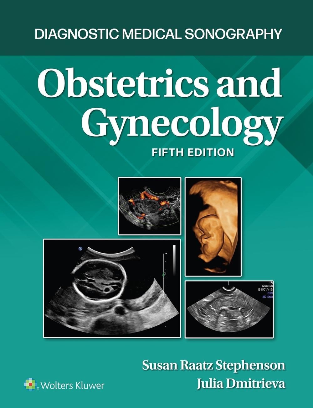 Diagnostic Medical Sonography: Obstetrics and Gynecology 5e Lippincott Connect P